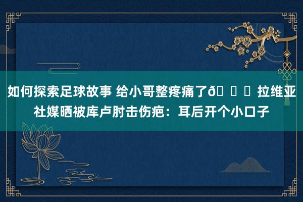 如何探索足球故事 给小哥整疼痛了😅拉维亚社媒晒被库卢肘击伤疤：耳后开个小口子